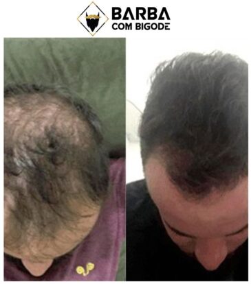 cabelo2-e1688604288805