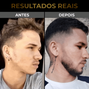 AURICELIO